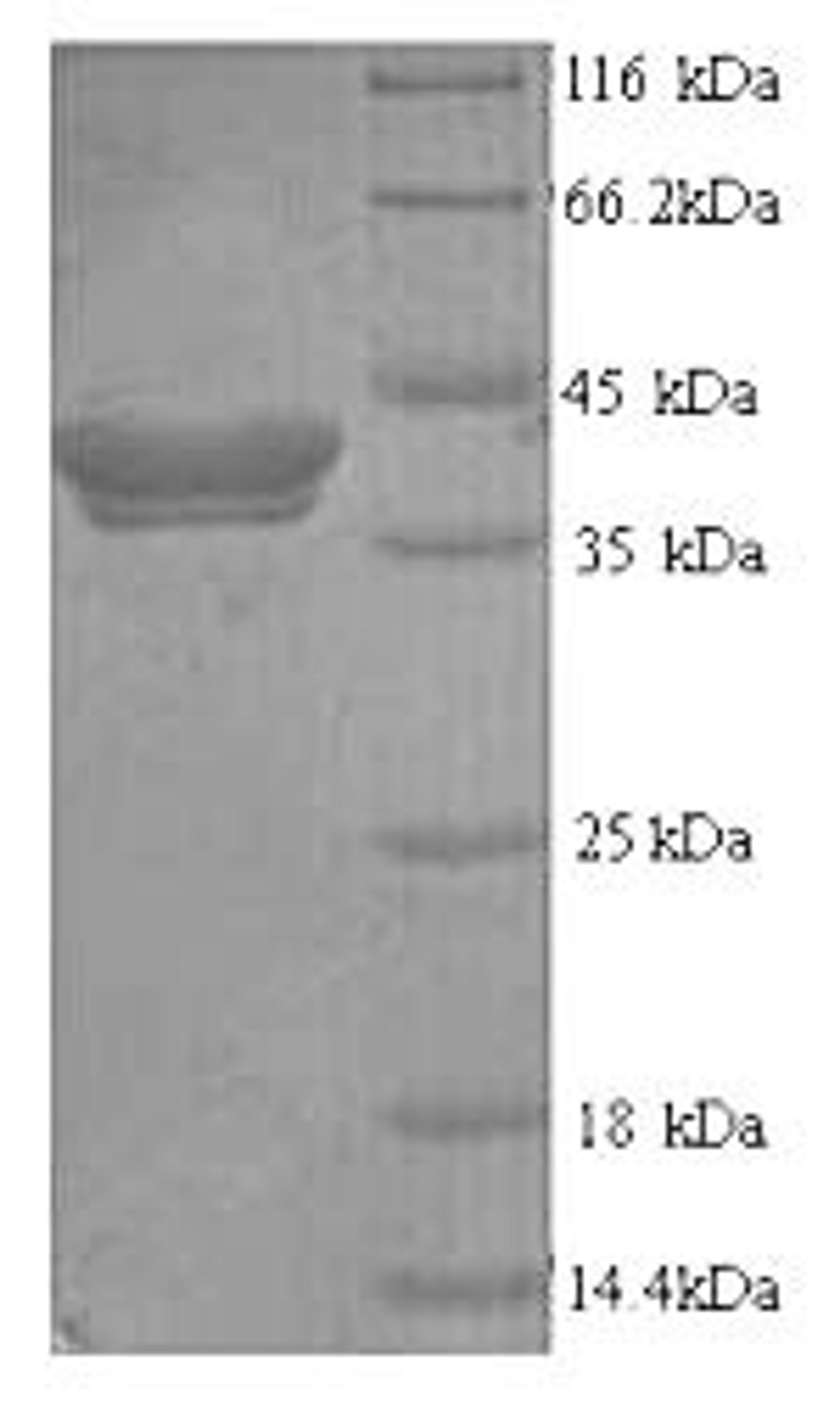 (Tris-Glycine gel) Discontinuous SDS-PAGE (reduced) with 5% enrichment gel and 15% separation gel.
