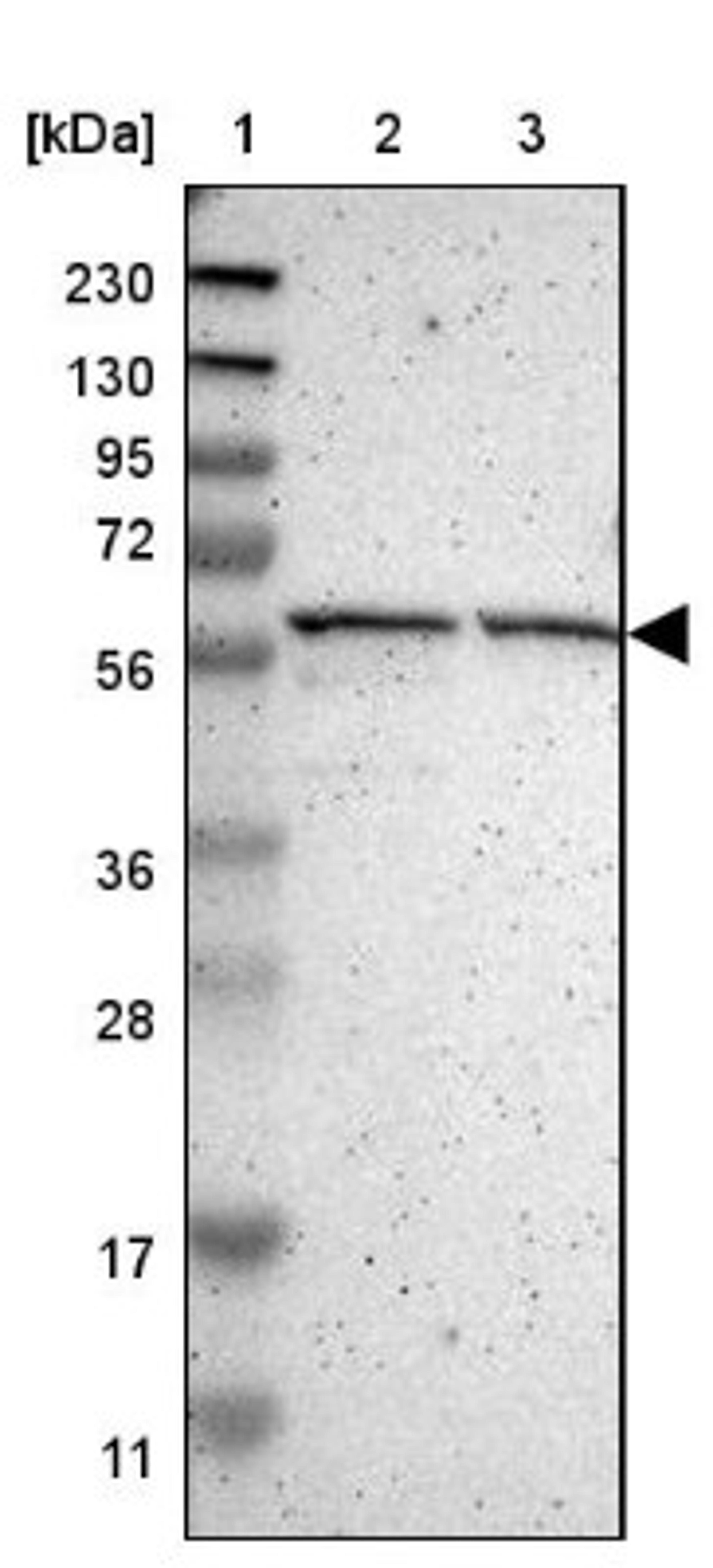 Western Blot: MMP19 Antibody [NBP1-82638] - Lane 1: Marker [kDa] 230, 130, 95, 72, 56, 36, 28, 17, 11<br/>Lane 2: Human cell line RT-4<br/>Lane 3: Human cell line U-251MG sp