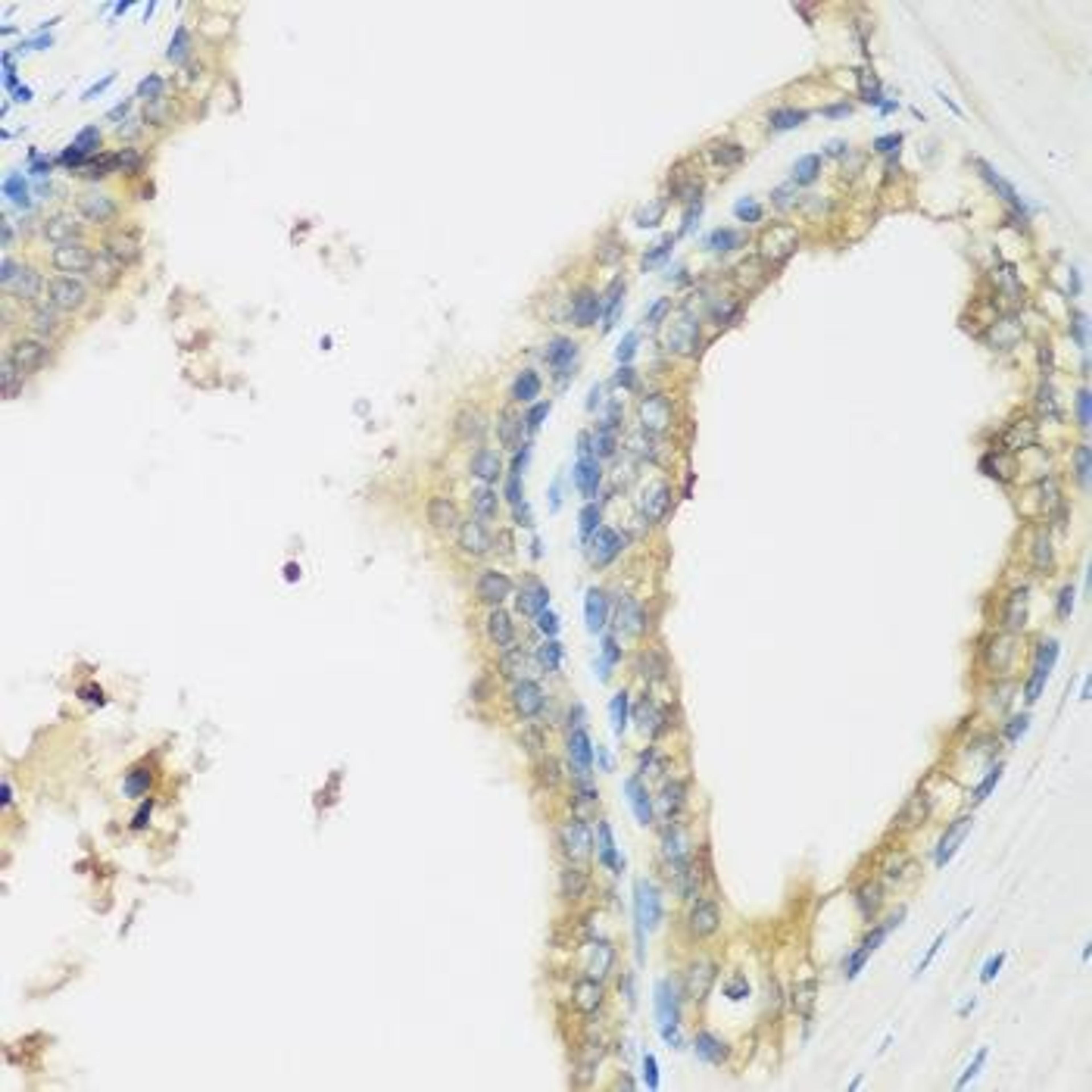 Immunohistochemical staining of human prostate tissue using WDR77 antibody (dilution of 1:200)