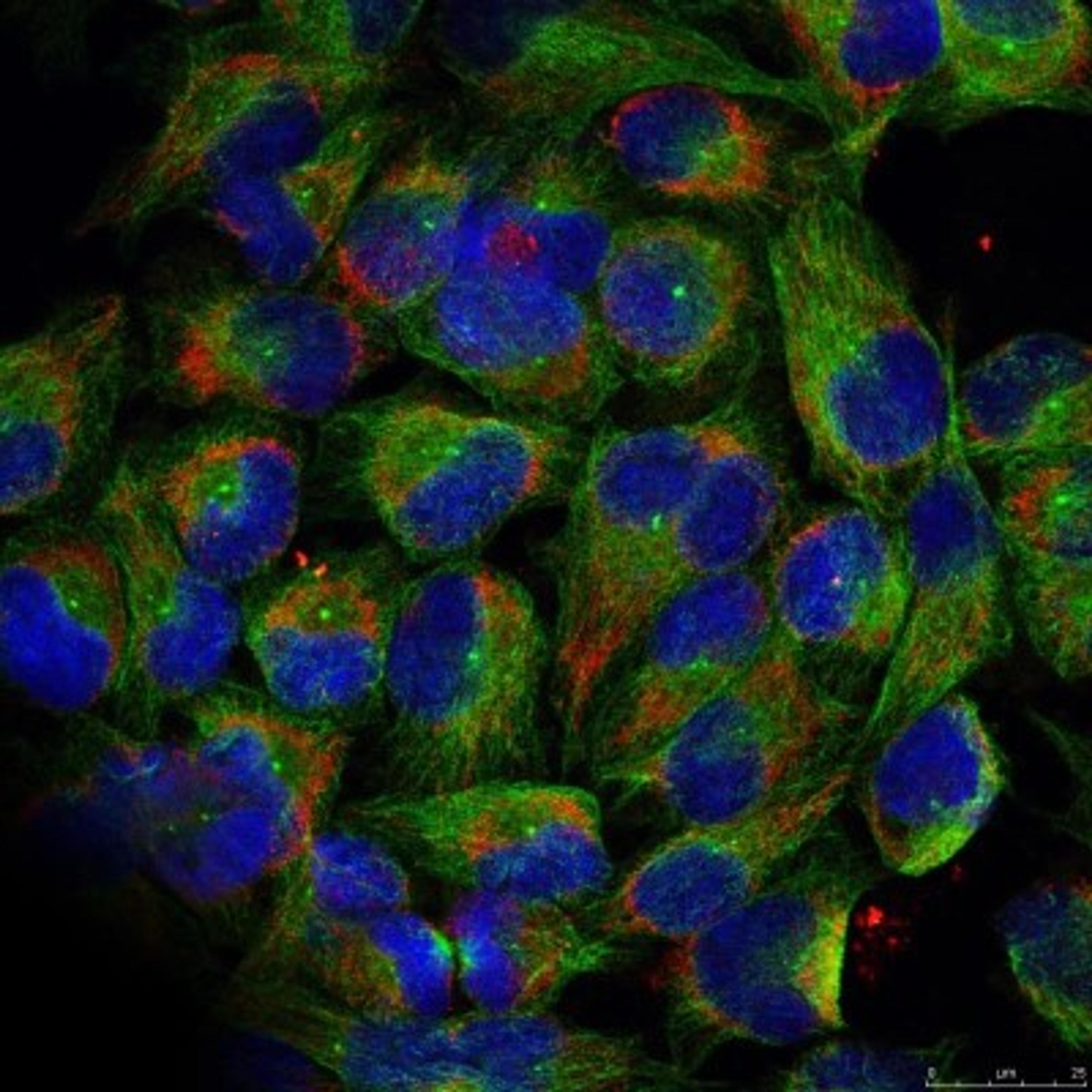 Immunocytochemistry/Immunofluorescence: NFkB p100/p52 [p Ser866] Antibody [NB100-82066] - Staining of methanol-fixed HeLa cells.