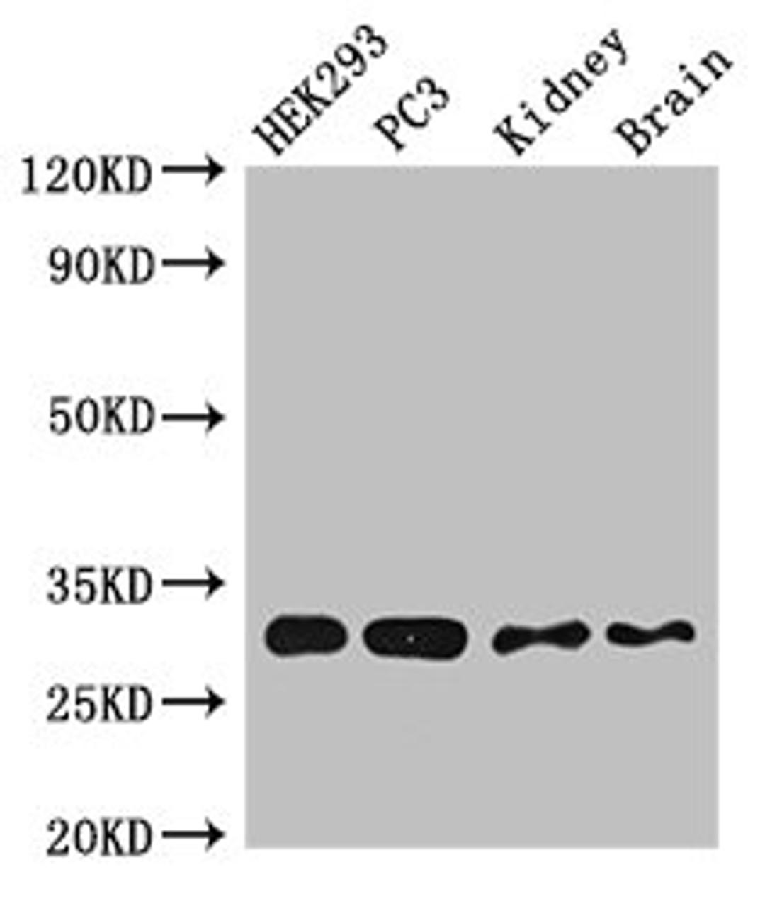 Western Blot. Positive WB detected in:HEK293 whole cell lysate,PC-3 whole cell lysate,Mouse kidney tissue,Mouse brain tissue. All lanes:CBR1 antibody at 2.5µg/ml. Secondary. Goat polyclonal to rabbit IgG at 1/50000 dilution. Predicted band size: 31,19 KDa. Observed band size: 31 KDa