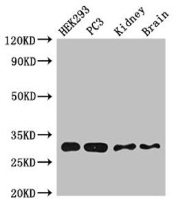 Western Blot. Positive WB detected in:HEK293 whole cell lysate,PC-3 whole cell lysate,Mouse kidney tissue,Mouse brain tissue. All lanes:CBR1 antibody at 2.5µg/ml. Secondary. Goat polyclonal to rabbit IgG at 1/50000 dilution. Predicted band size: 31,19 KDa. Observed band size: 31 KDa