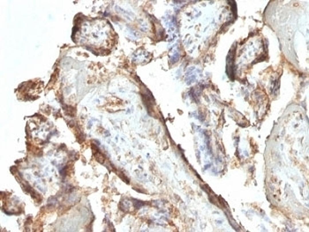 Formalin-fixed, paraffin-embedded human placenta stained with hCG Holo antibody (HCGab/52).