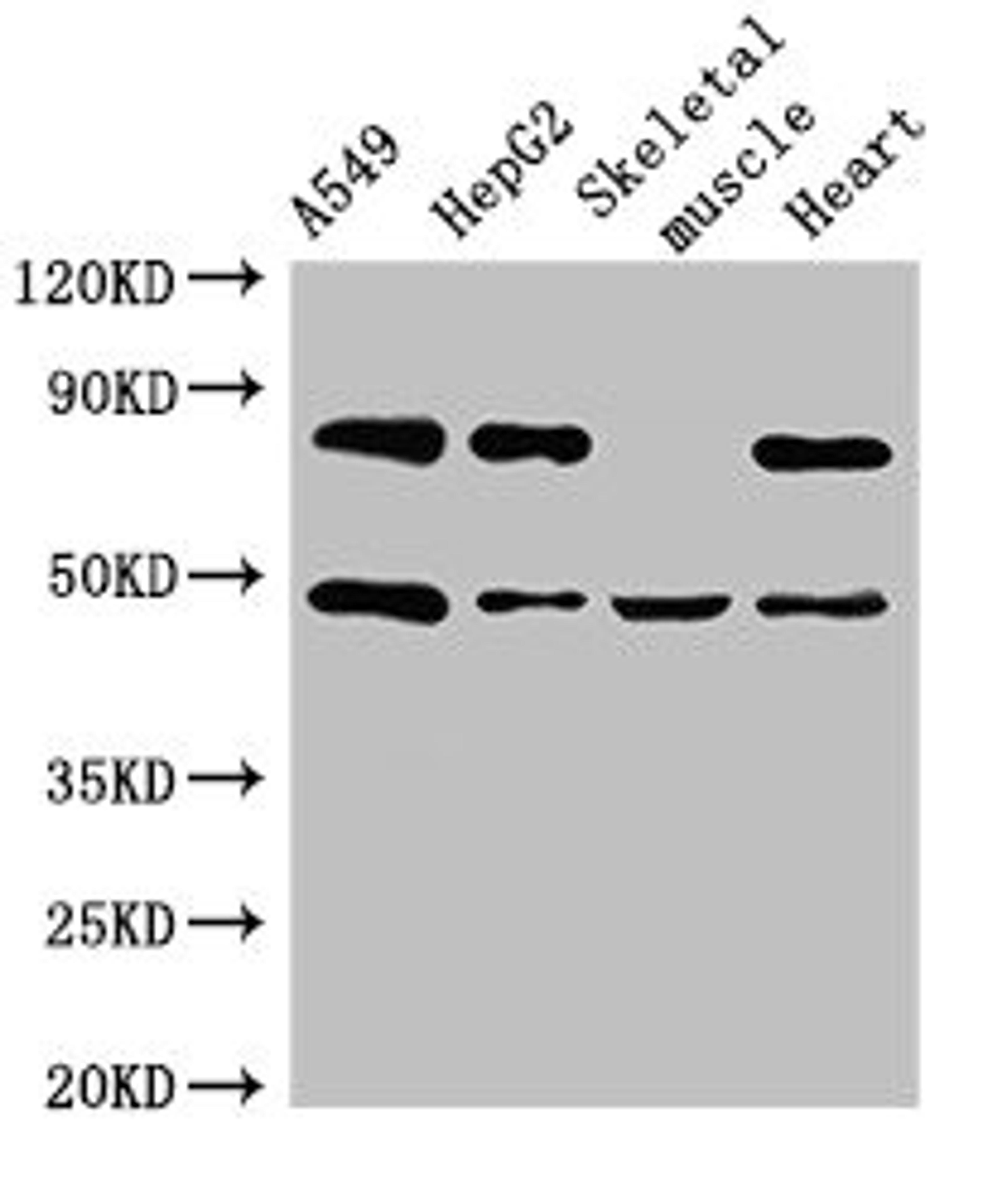 Western Blot. Positive WB detected in: A549 whole cell lysate, HepG2 whole cell lysate, Mouse skeletal muscle tissue, Rat heart tissue. All lanes: ASB4 antibody at 3µg/ml. Secondary. Goat polyclonal to rabbit IgG at 1/50000 dilution. Predicted band size: 49, 39 kDa. Observed band size: 49 kDa