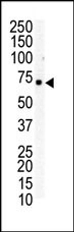 Western blot analysis of anti-EphB6 C-term Pab in Jurkat cell lysate