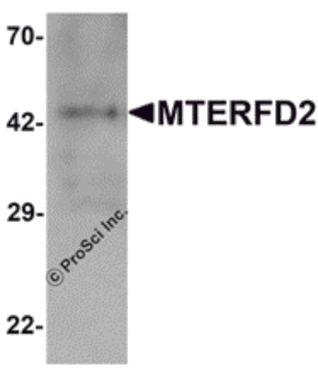 Western blot analysis of MTERFD2 in human small intestine tissue lysate with MTERFD2 antibody at 1 &#956;g/mL.