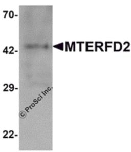 Western blot analysis of MTERFD2 in human small intestine tissue lysate with MTERFD2 antibody at 1 μg/mL.