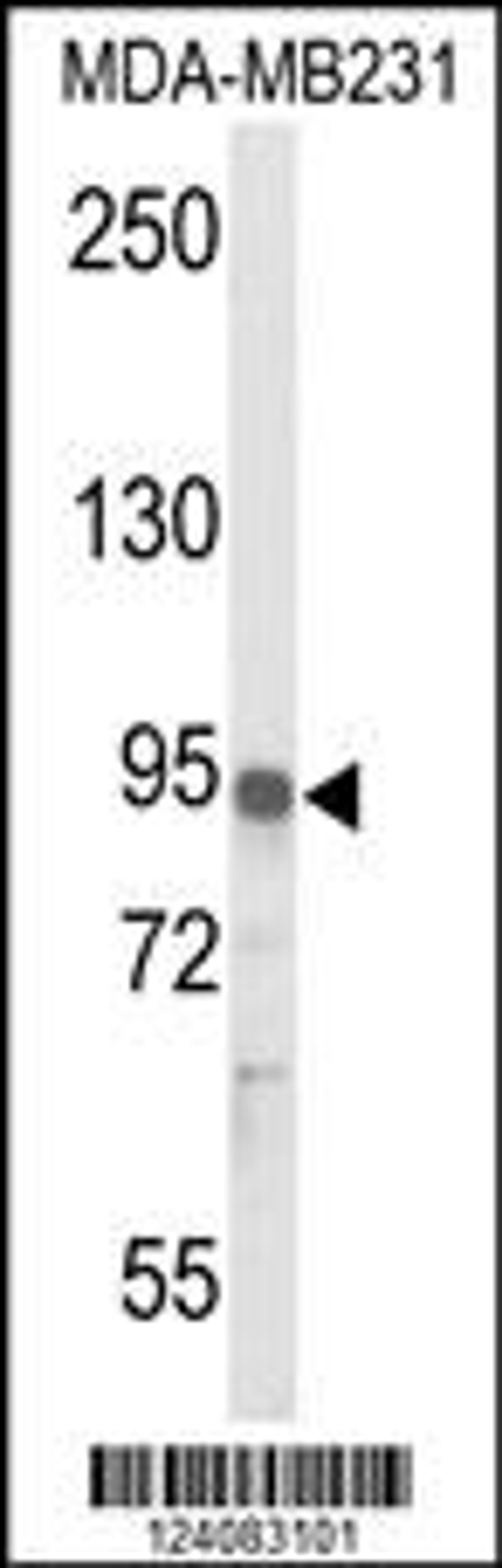 Western blot analysis of IL17RD Antibody in MDA-MB231 cell line lysates (35ug/lane)