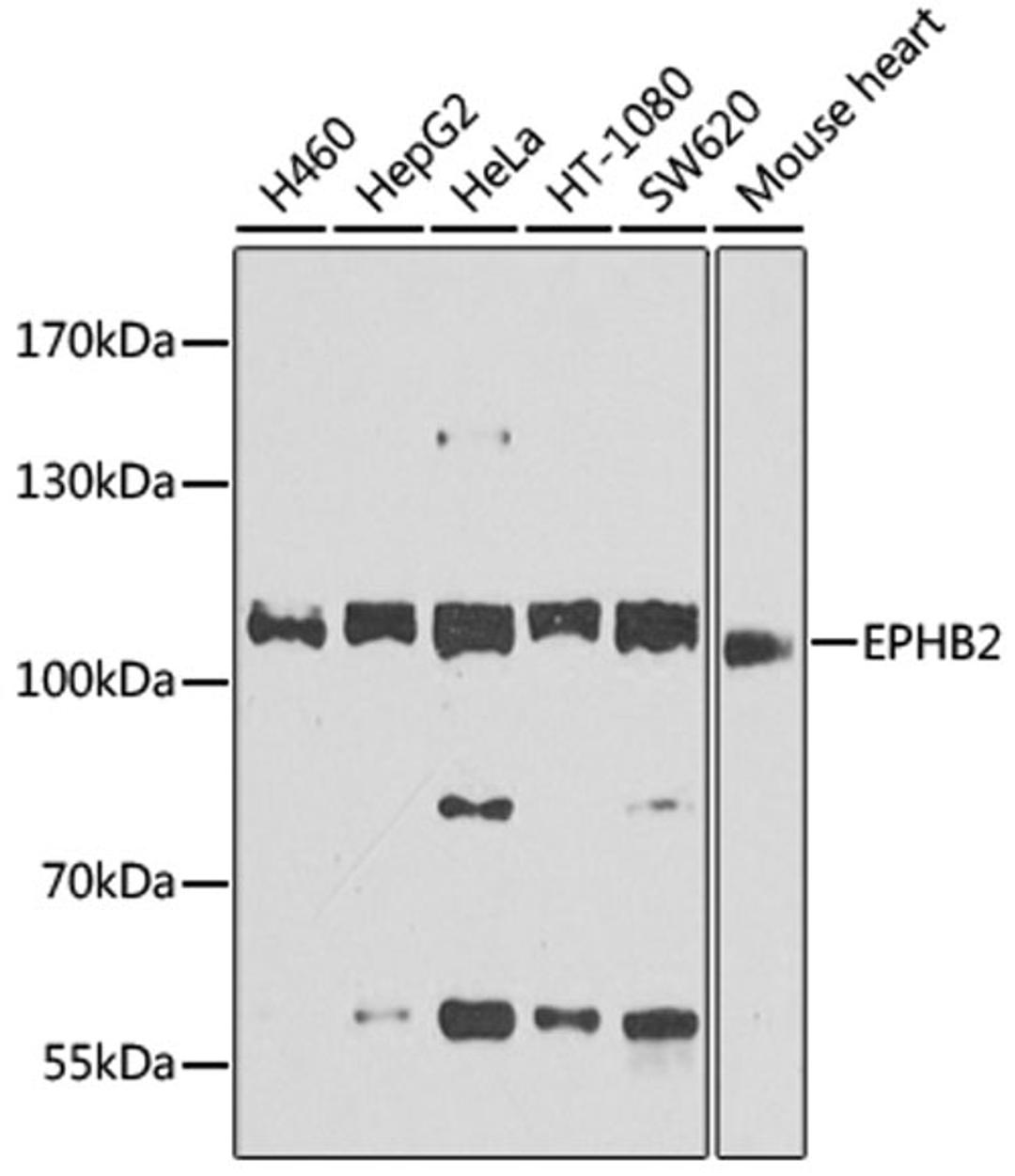 Western blot - EPHB2 antibody (A9813)