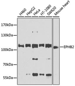 Western blot - EPHB2 antibody (A9813)