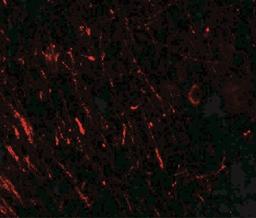 Immunofluorescence: PRAS40 Antibody [NBP2-41221] - PRAS40 in rat brain tissue with PRAS 40 antibody at 20 ug/ml.