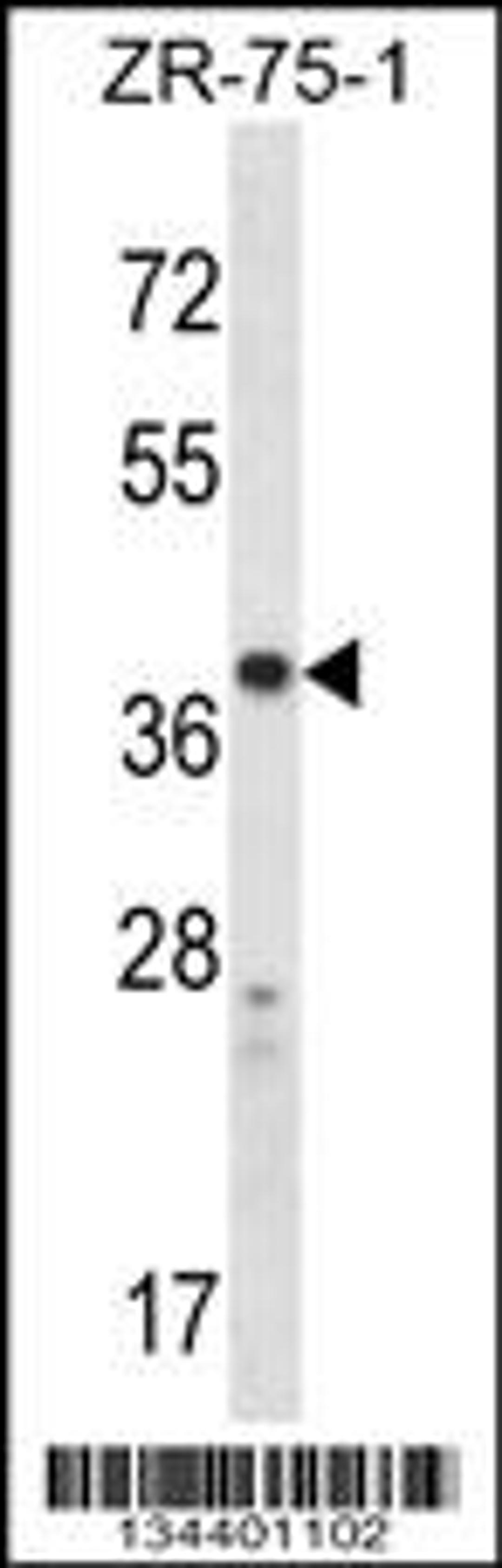 Western blot analysis in ZR-75-1 cell line lysates (35ug/lane).