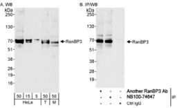 Western Blot: RanBP3 Antibody [NB100-74647] - Detection of Human and Mouse RanBP3 by Western Blot (h&m) and Immunoprecipitation (h). Samples: Whole cell lysate from HeLa (5, 15 and 50 mcg for WB; 1 mg for IP, 20% of IP loaded), 293T (T; 50 mcg) and mouse NIH3T3 (M; 50 mcg) cells. Antibodies: Affinity purified rabbit anti-RanBP3 antibody NB100-74647 used for WB at 0.04 mcg/ml (A) and 1 mcg/ml (B) and used for IP at 3 mcg/mg lysate. RanBP3 was also immunoprecipitated by another rabbit anti-RanBP3 antibody, which recognizes an upstream epitope. Detection: Chemiluminescence with exposure times of 10 seconds (A) and 3 seconds (B).