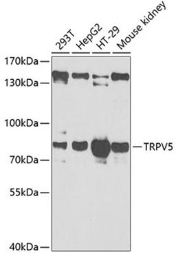 Western blot - TRPV5 antibody (A6473)