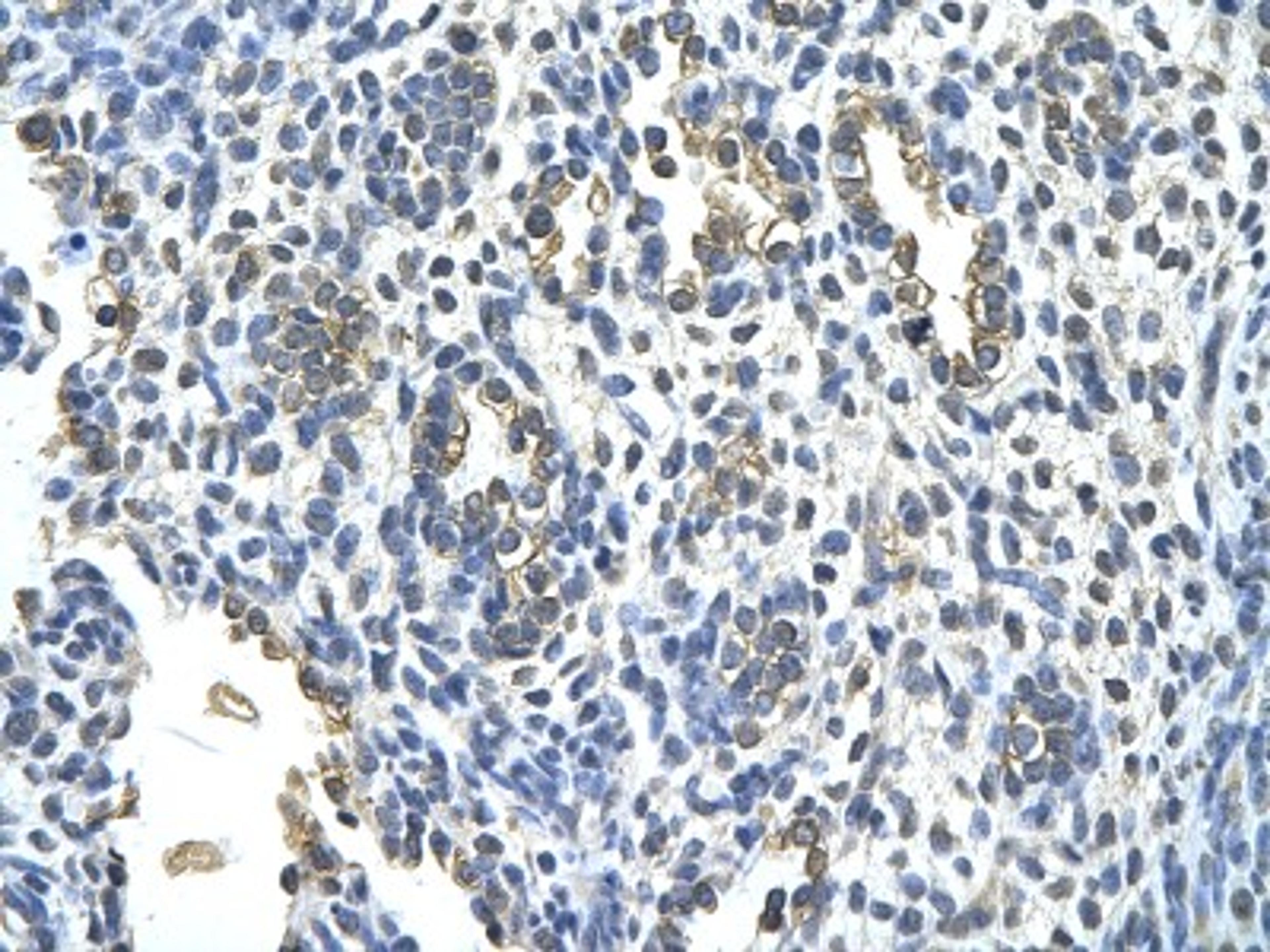 Immunohistochemistry: Cytokeratin 2 Antibody [NBP1-55126] - Human alveolar cell Cellular data: Epithelial cells of renal tubule Antibody Concentration: 4.0-8.0 ug/ml Magnification: 400X.