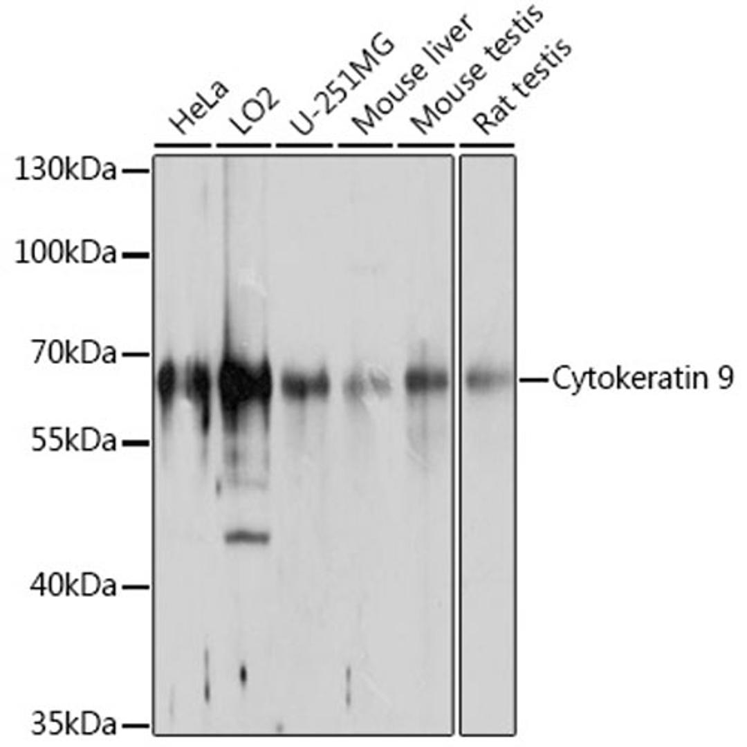 Western blot - Cytokeratin 9 antibody (A10119)