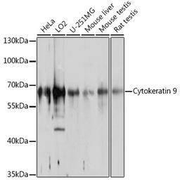 Western blot - Cytokeratin 9 antibody (A10119)