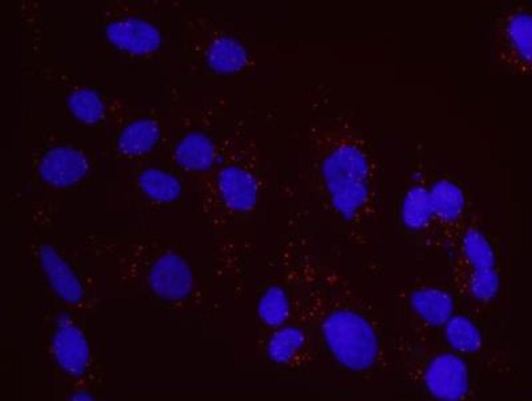 Proximity Ligation Assay: CtIP Antibody [NB100-79810] - Secondary-conjugate Duolink II PLA in Hela cells. goat anti-human ATM (NB100-271) and rabbit anti-human CtIP (NB100-79810). Image merged from DAPI (2ms) and Texas Red (200ms) exposures, 40X magnification.