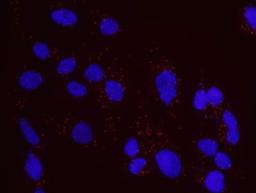 Proximity Ligation Assay: CtIP Antibody [NB100-79810] - Secondary-conjugate Duolink II PLA in Hela cells. goat anti-human ATM (NB100-271) and rabbit anti-human CtIP (NB100-79810). Image merged from DAPI (2ms) and Texas Red (200ms) exposures, 40X magnification.