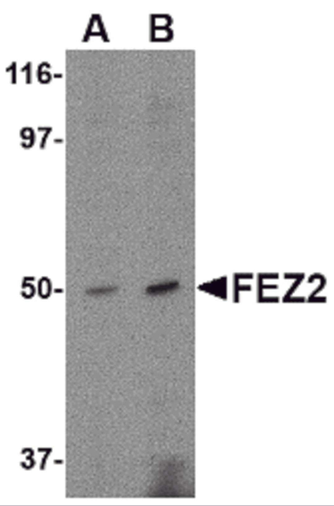 Western blot analysis of FEZ2 in mouse brain tissue lysate with FEZ2 antibody at (A) 0.5, and (B) 1 μg/mL.