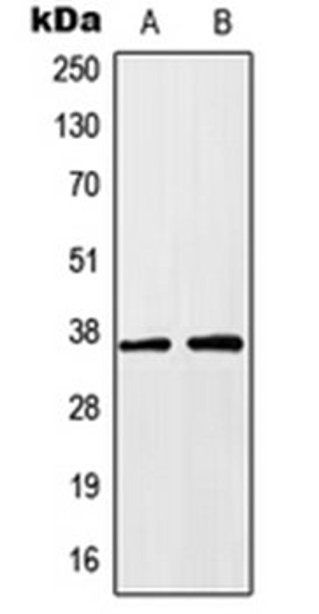 Western blot analysis of HEK293T (Lane 1), HeLa (Lane 2) whole cell lysates using HOXA1 antibody