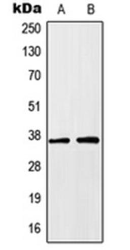 Western blot analysis of HEK293T (Lane 1), HeLa (Lane 2) whole cell lysates using HOXA1 antibody