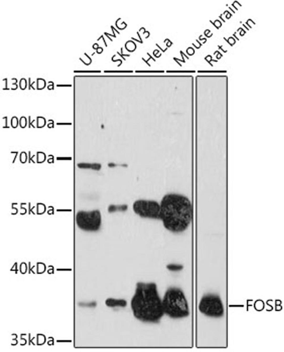 Western blot - FOSB antibody (A14696)