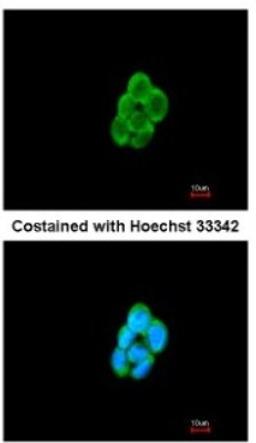 Immunocytochemistry/Immunofluorescence: CMTM6 Antibody [NBP1-31183] - Analysis of methanol-fixed A431, using antibody at 1:200 dilution.