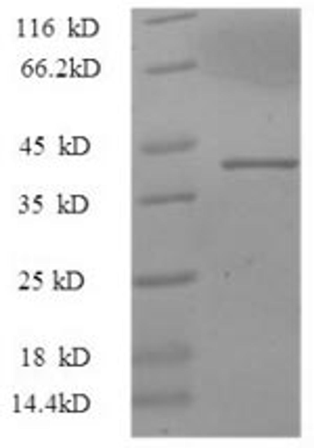 (Tris-Glycine gel) Discontinuous SDS-PAGE (reduced) with 5% enrichment gel and 15% separation gel.