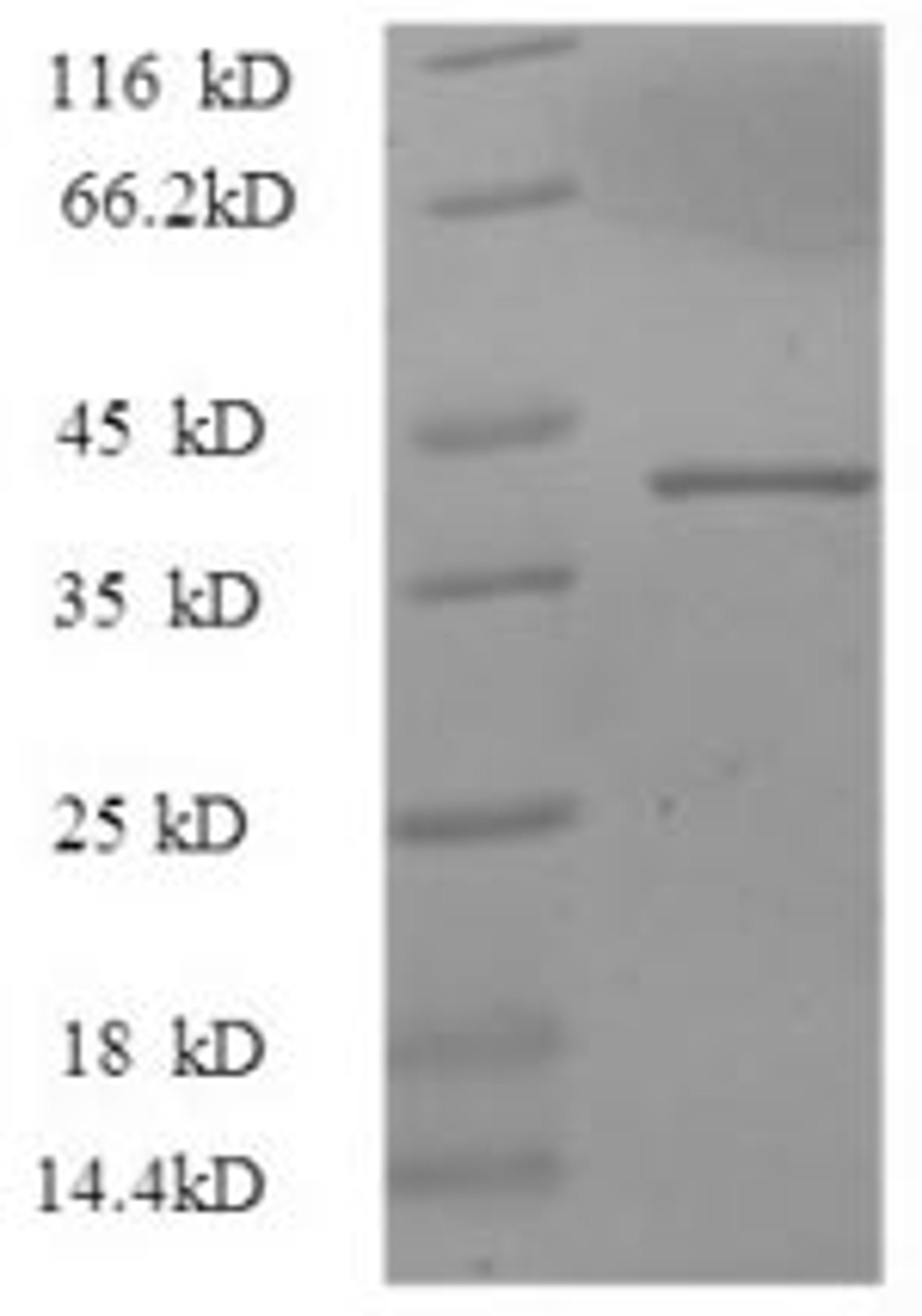(Tris-Glycine gel) Discontinuous SDS-PAGE (reduced) with 5% enrichment gel and 15% separation gel.