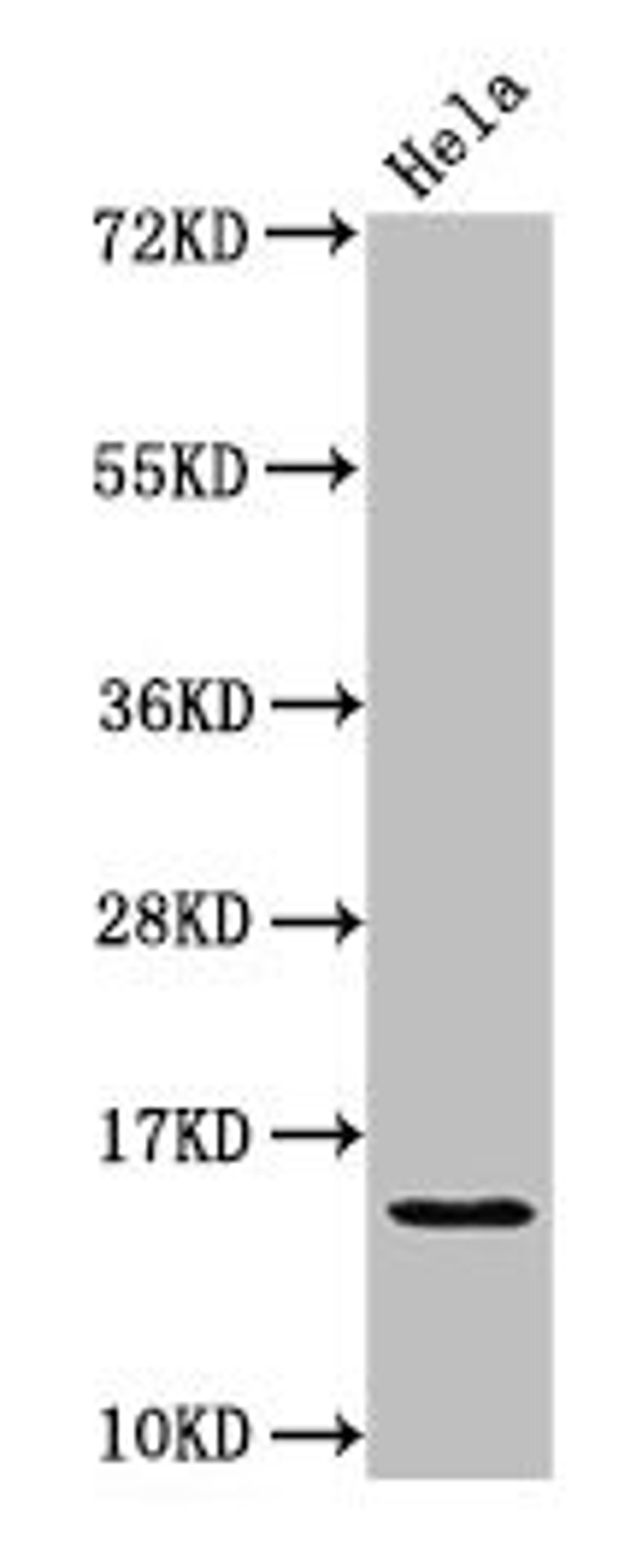 Western Blot. Positive WB detected in: Hela whole cell lysate. All lanes: HIST1H2AG antibody at 1.25µg/ml. Secondary. Goat polyclonal to rabbit IgG at 1/50000 dilution. Predicted band size: 15 kDa. Observed band size: 15 kDa