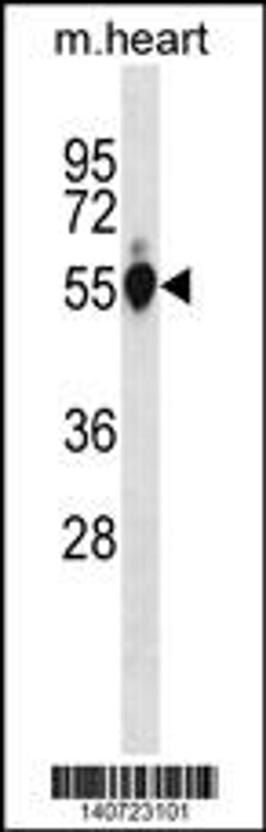 Western blot analysis in mouse heart tissue lysates (35ug/lane).