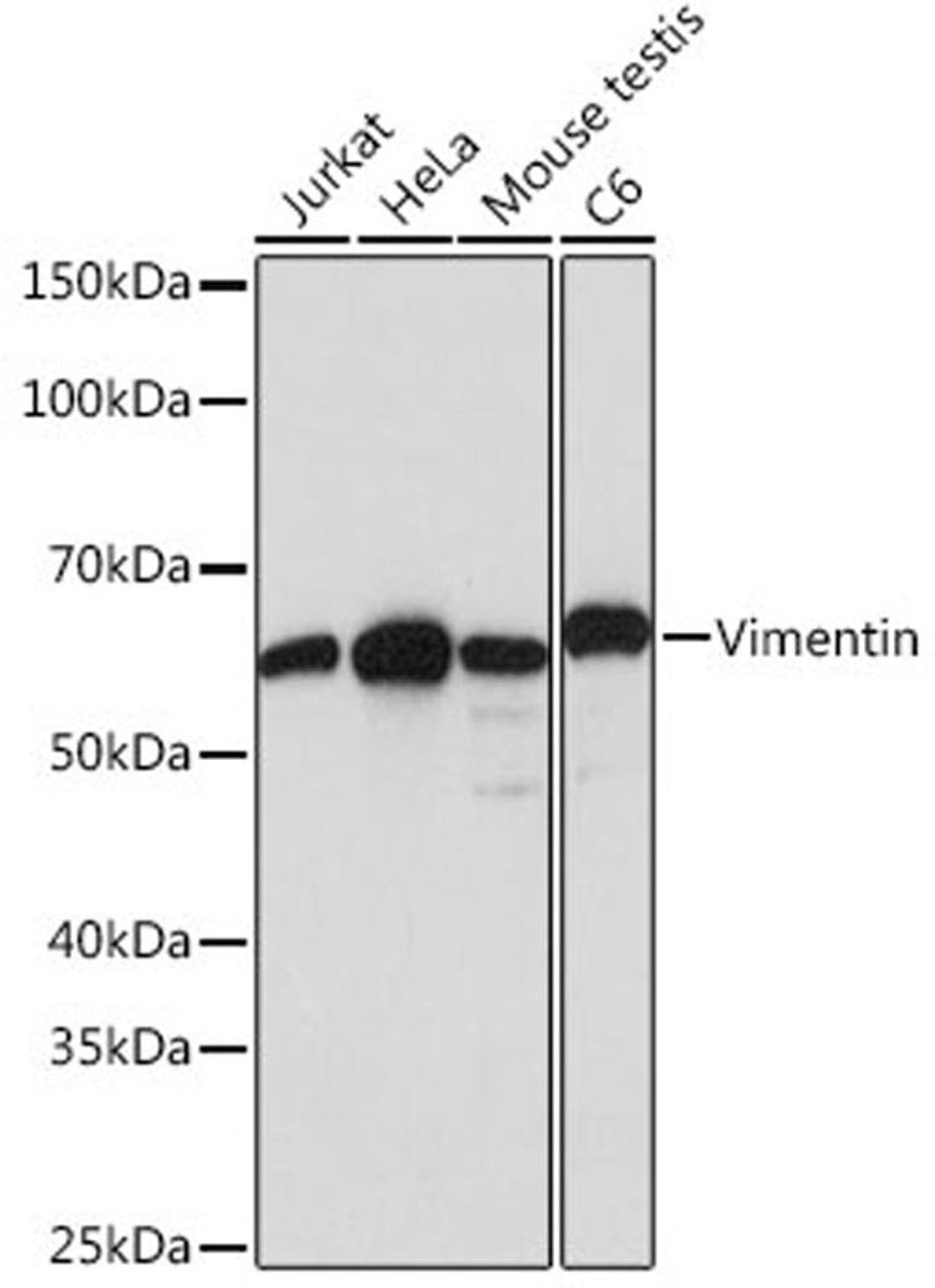 Western blot - Vimentin antibody (A19607)