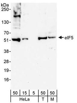 Detection of human and mouse eIF5 by western blot.