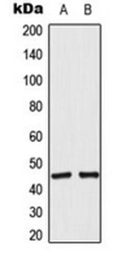 Western blot analysis of RT4 (Lane 1), A549 (Lane 2) whole cell lysates using ACOT4 antibody