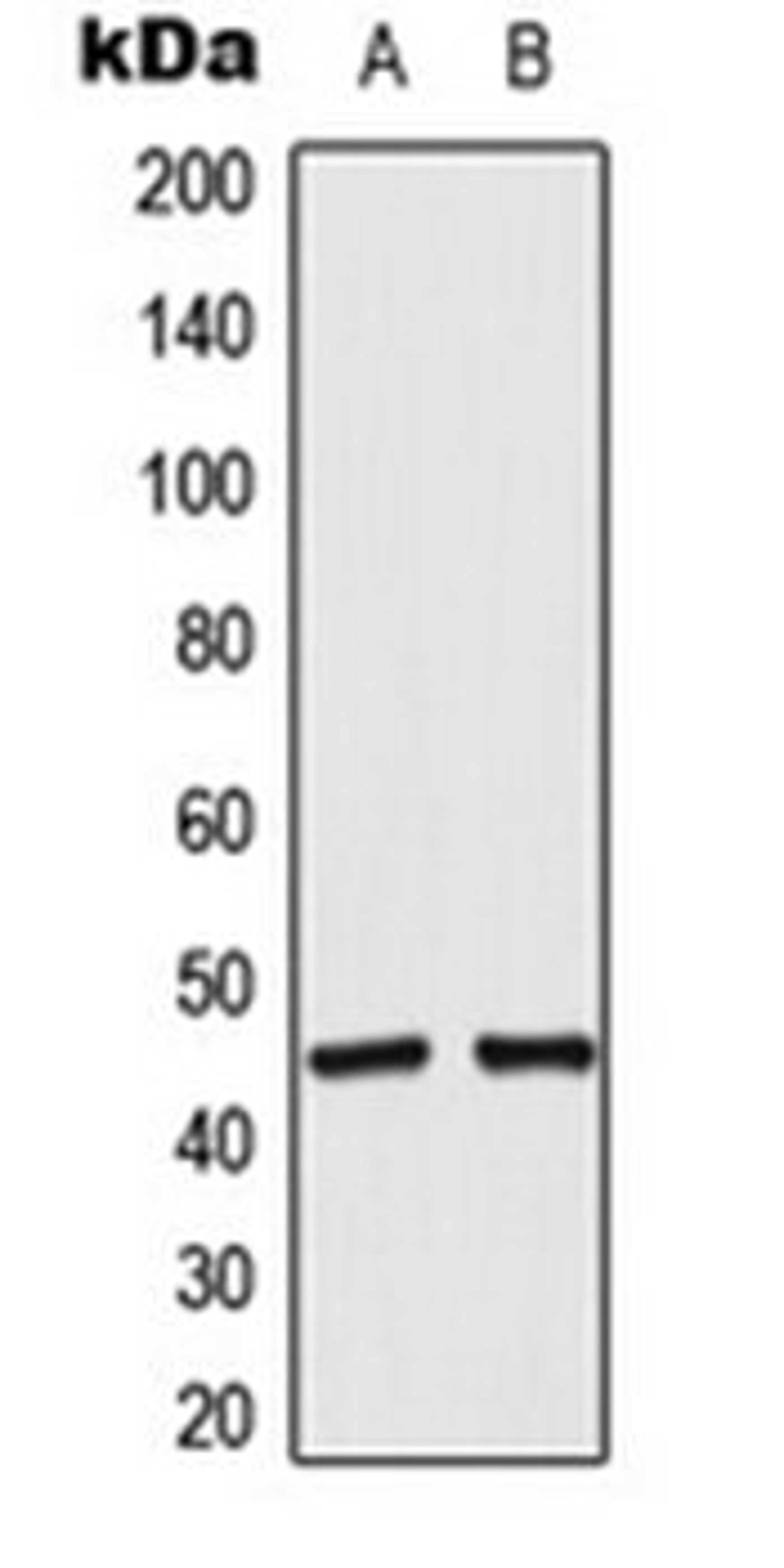 Western blot analysis of RT4 (Lane 1), A549 (Lane 2) whole cell lysates using ACOT4 antibody