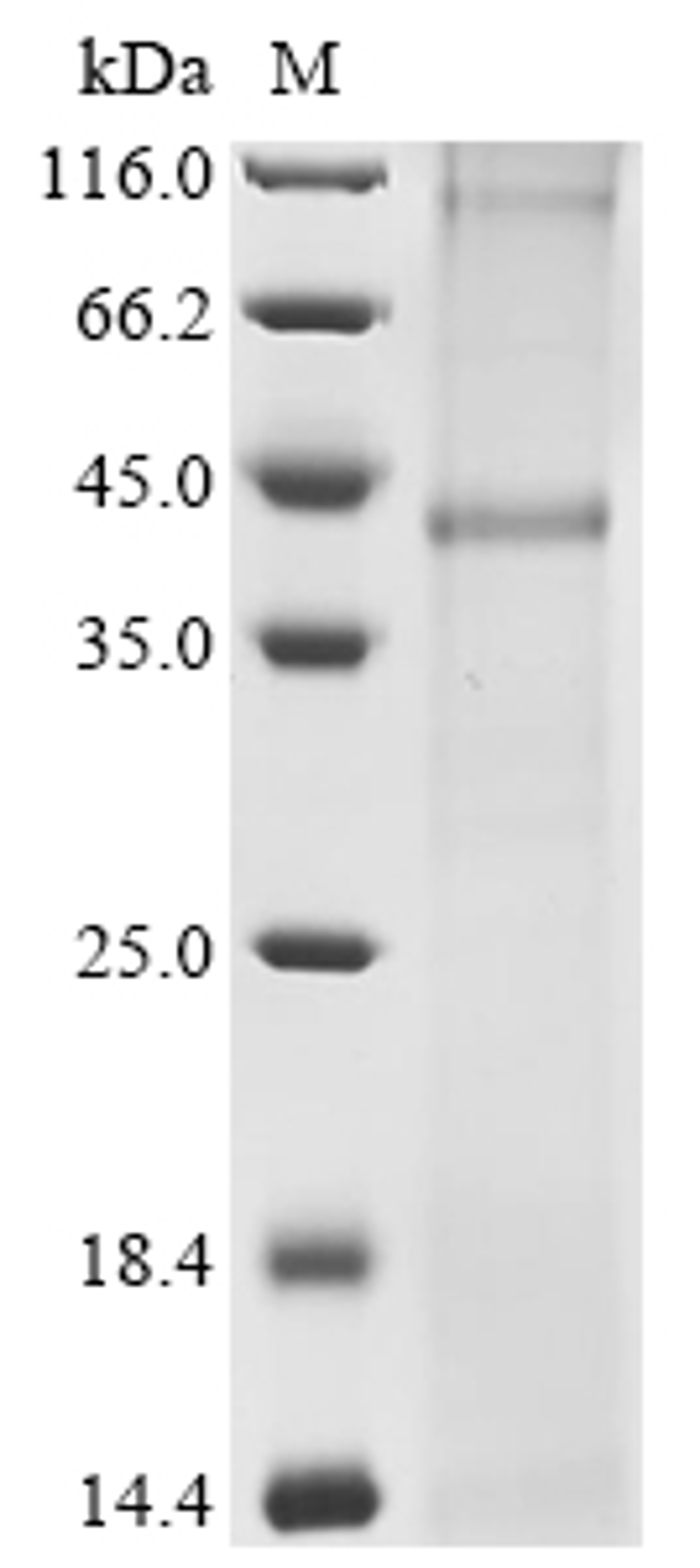 (Tris-Glycine gel) Discontinuous SDS-PAGE (reduced) with 5% enrichment gel and 15% separation gel.