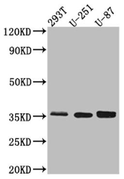 Western Blot. Positive WB detected in: 293T whole cell lysate, U-251 whole cell lysate, U-87 whole cell lysate. All lanes: Osteopontin Antibody at 1:1000. Secondary. Goat polyclonal to rabbit IgG at 1/50000 dilution. Predicted band size: 36, 34, 33, 34, 34 kDa. Observed band size: 36 kDa. 