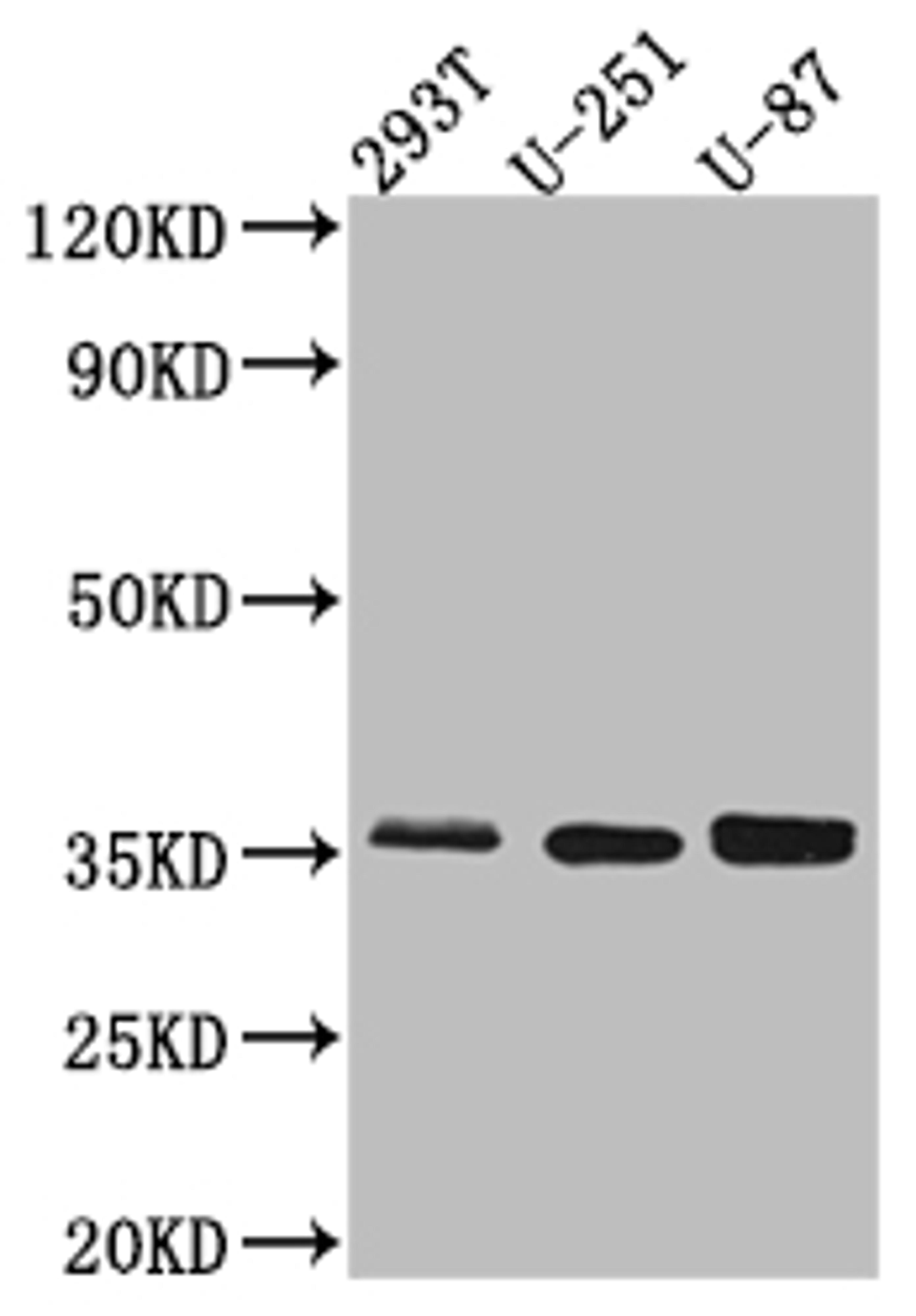 Western Blot. Positive WB detected in: 293T whole cell lysate, U-251 whole cell lysate, U-87 whole cell lysate. All lanes: Osteopontin Antibody at 1:1000. Secondary. Goat polyclonal to rabbit IgG at 1/50000 dilution. Predicted band size: 36, 34, 33, 34, 34 kDa. Observed band size: 36 kDa. 