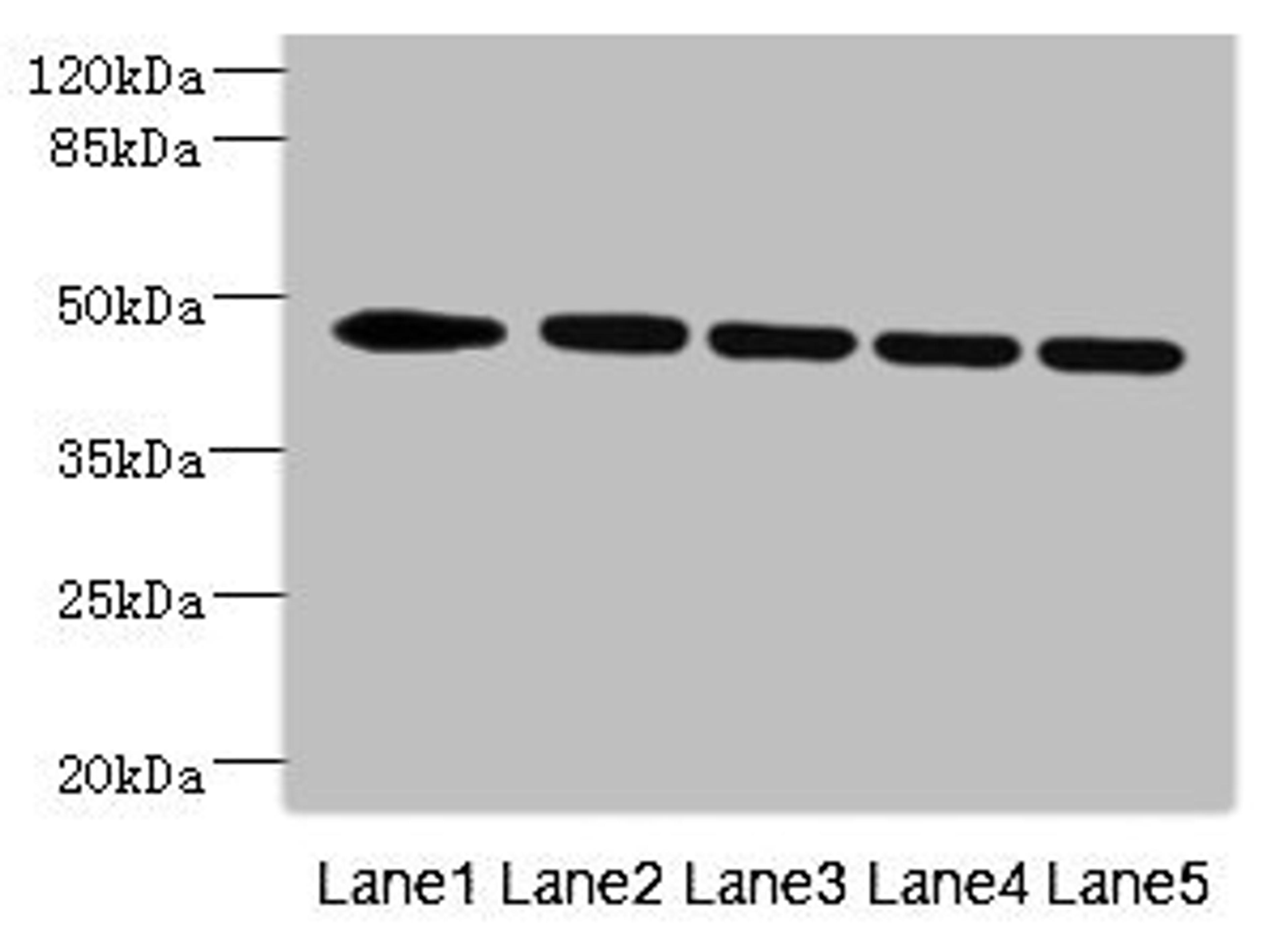 Western blot. All lanes: DCXR antibody at 4.74ug/ml. Lane 1: MCF-7 whole cell lysate. Lane 2: Hela whole cell lysate. Lane 3: A549 whole cell lysate. Lane 4: 293T whole cell lysate. Secondary. Goat polyclonal to rabbit IgG at 1/10000 dilution. Predicted band size: 45 kDa. Observed band size: 45 kDa. 