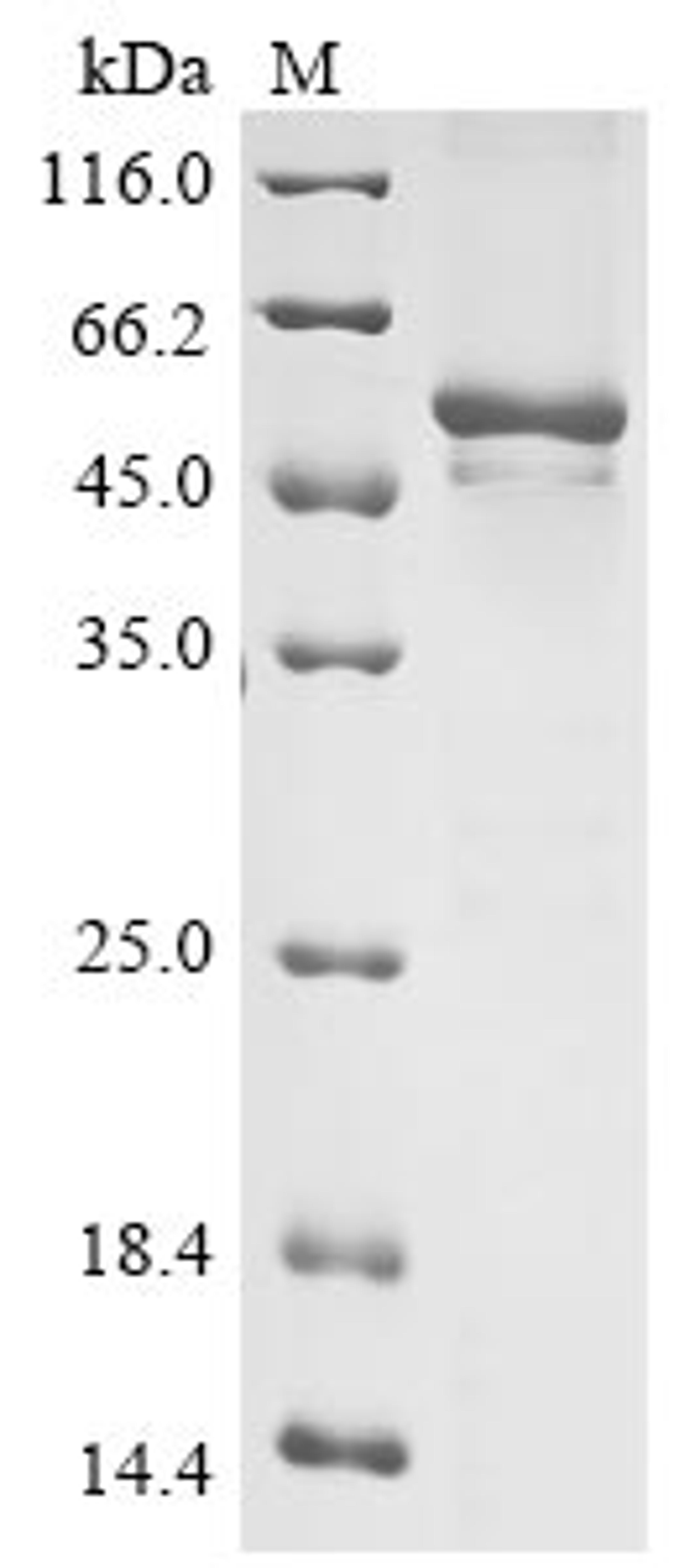 (Tris-Glycine gel) Discontinuous SDS-PAGE (reduced) with 5% enrichment gel and 15% separation gel.