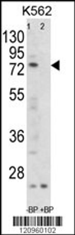 Western blot analysis of FLCN Antibody Pab pre-incubated without(lane 1) and with(lane 2) blocking peptide in K562 cell line lysate