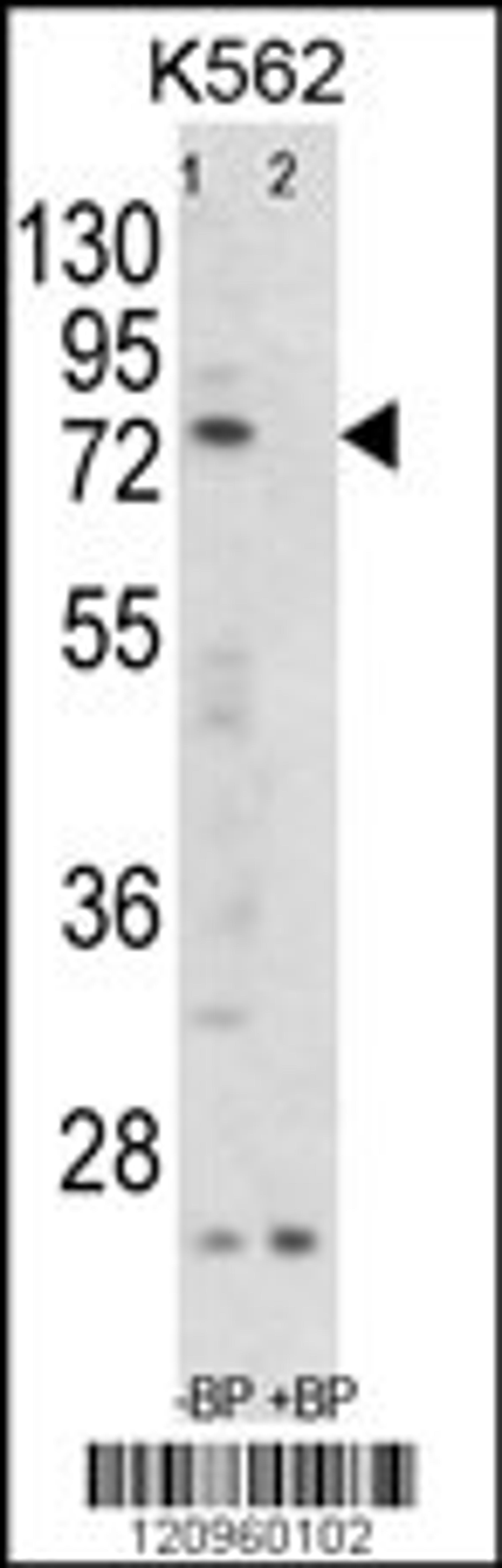 Western blot analysis of FLCN Antibody Pab pre-incubated without(lane 1) and with(lane 2) blocking peptide in K562 cell line lysate