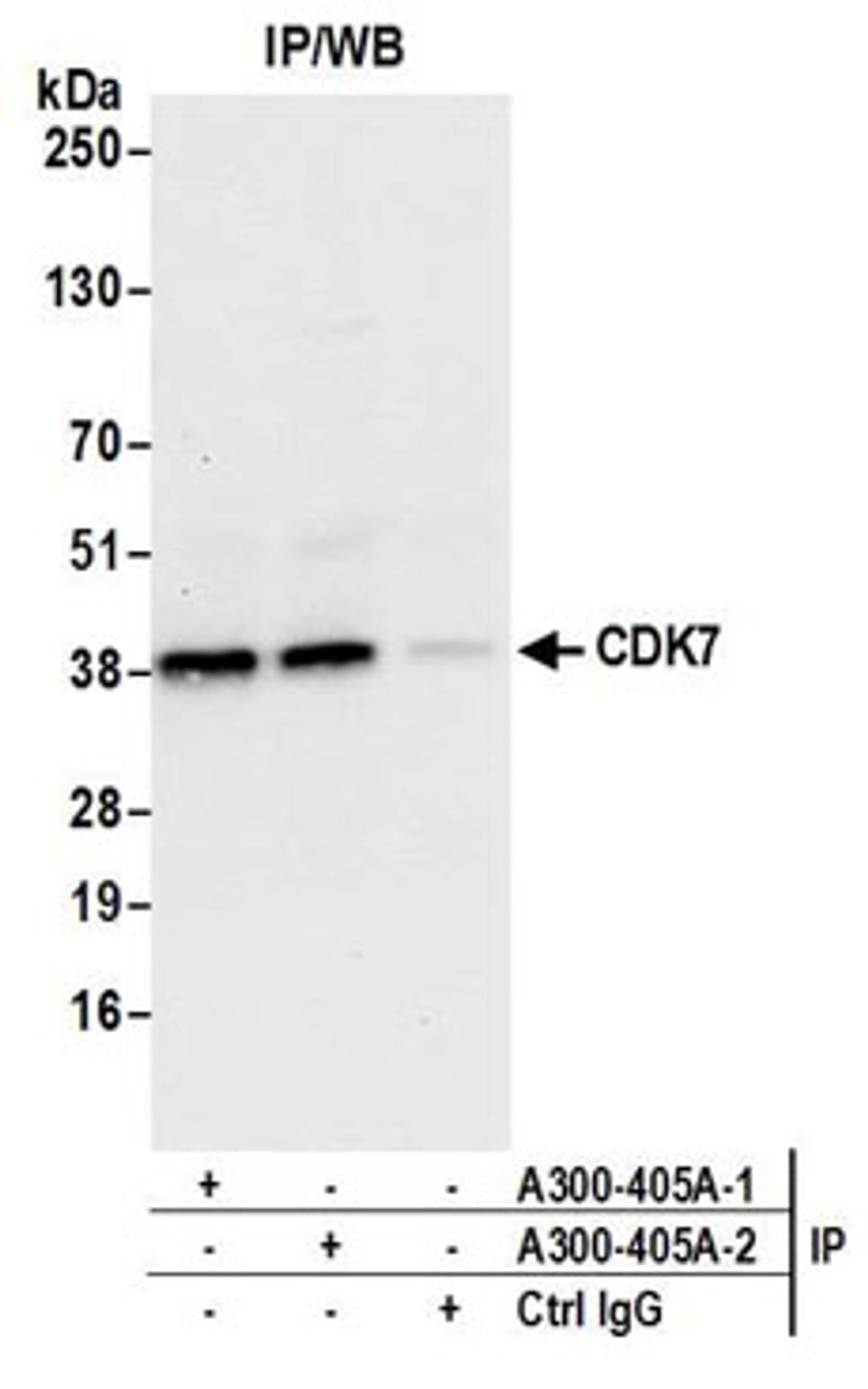 Detection of human CDK7 by western blot of immunoprecipitates.