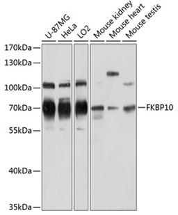 Western blot - FKBP10 antibody (A12931)