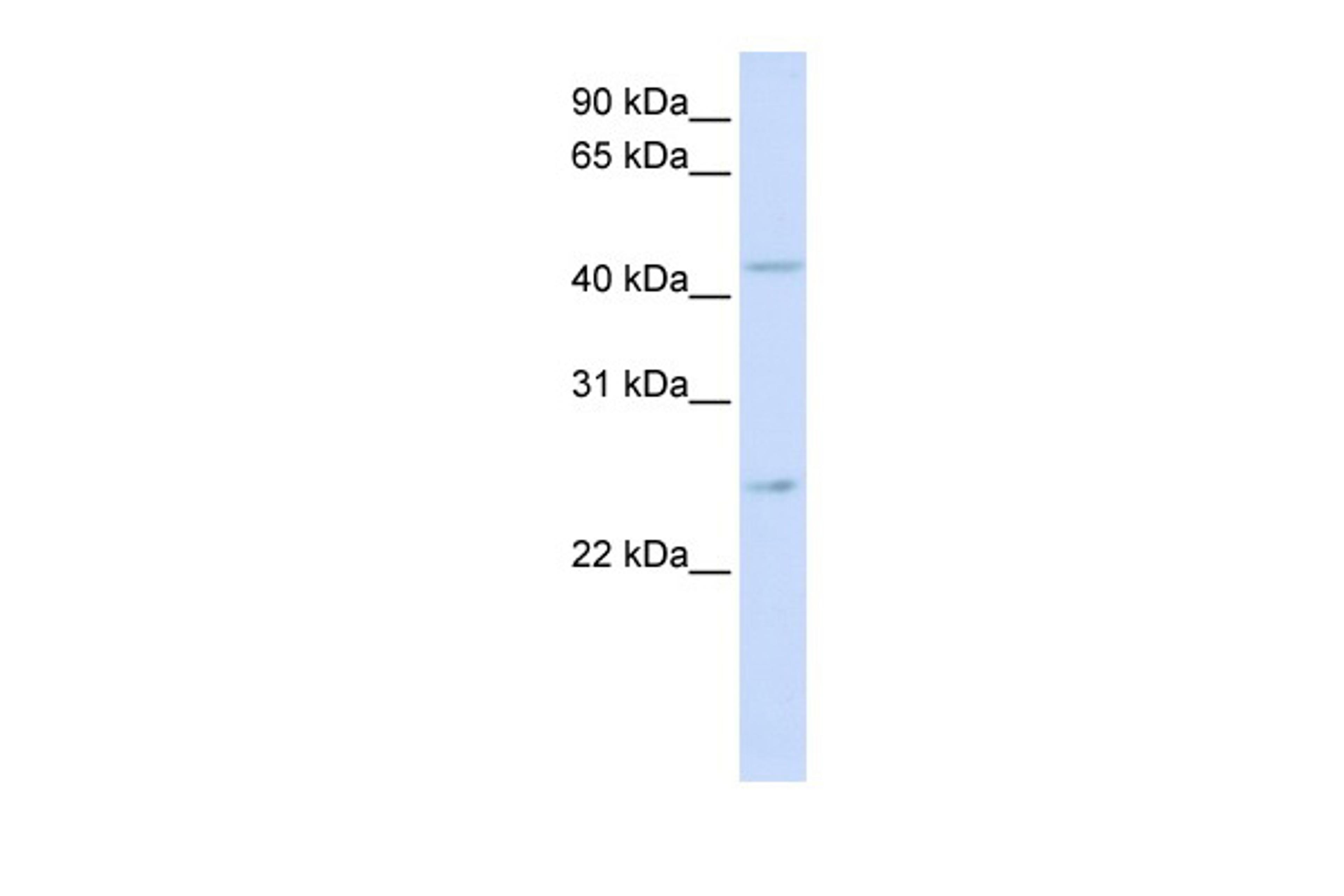 Antibody used in WB on Human Brain at 0.2-1 ug/ml.