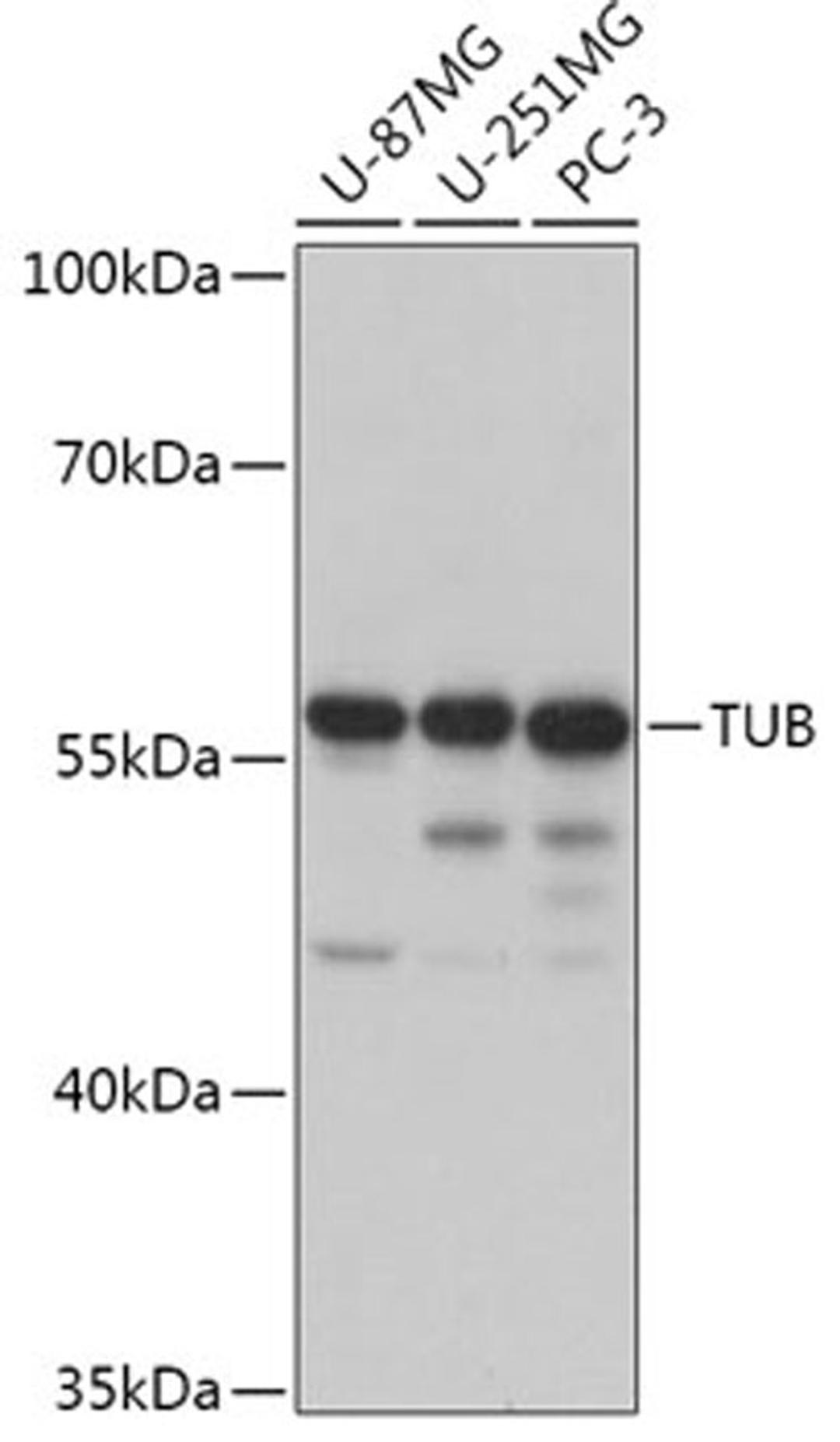 Western blot - TUB antibody (A17545)