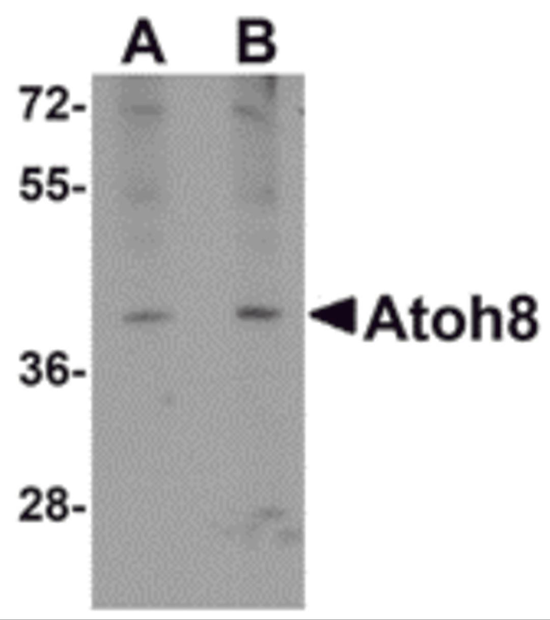 Western blot analysis of ATOH8 in A-20 cell lysate with ATOH8 antibody at (A) 1 and (B) 2 &#956;g/mL.