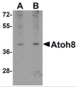 Western blot analysis of ATOH8 in A-20 cell lysate with ATOH8 antibody at (A) 1 and (B) 2 &#956;g/mL.