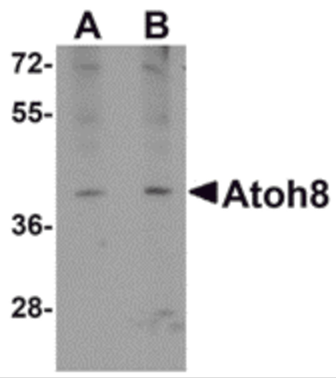 Western blot analysis of ATOH8 in A-20 cell lysate with ATOH8 antibody at (A) 1 and (B) 2 μg/mL.